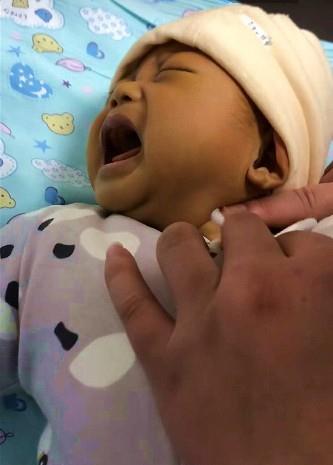 孩子脸发黄,妈妈没在意,低烧不退去医院,医生慌了忙叫转院手术|黄疸