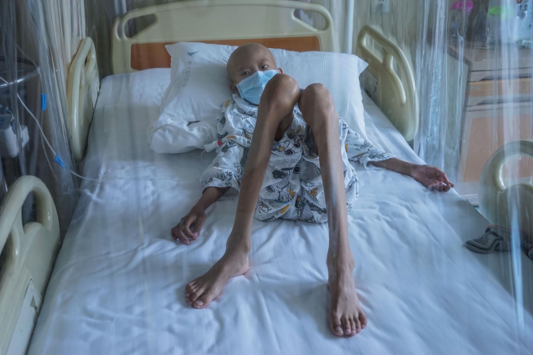 血癌男孩禁食4个月仅剩38斤,无法下床行走却坚持每天练书法