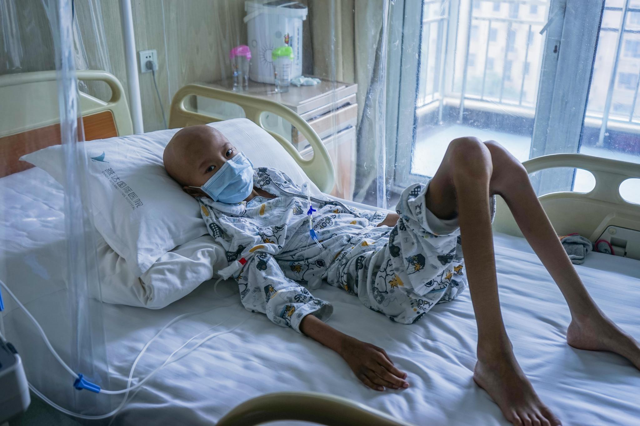 血癌男孩禁食4个月仅剩38斤,无法下床行走却坚持每天练书法