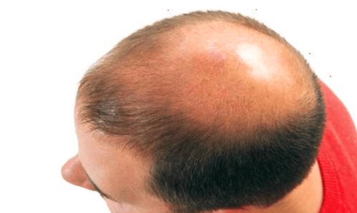 看人俗语: "穷人脚上无毛,富人头顶放光", 说的有没有道理?