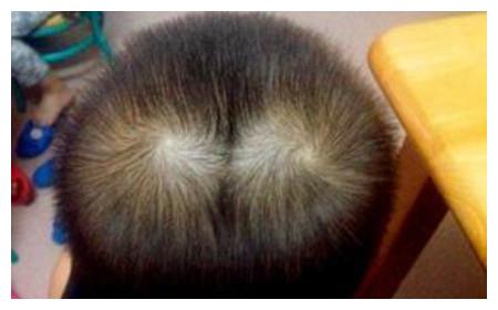 宝宝的发旋决定智商的高低?原来还隐藏着这样的秘密!
