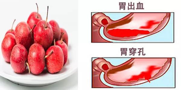 北京东大肛肠医院:胃穿孔只是胃破了一个洞?其实没那么简单