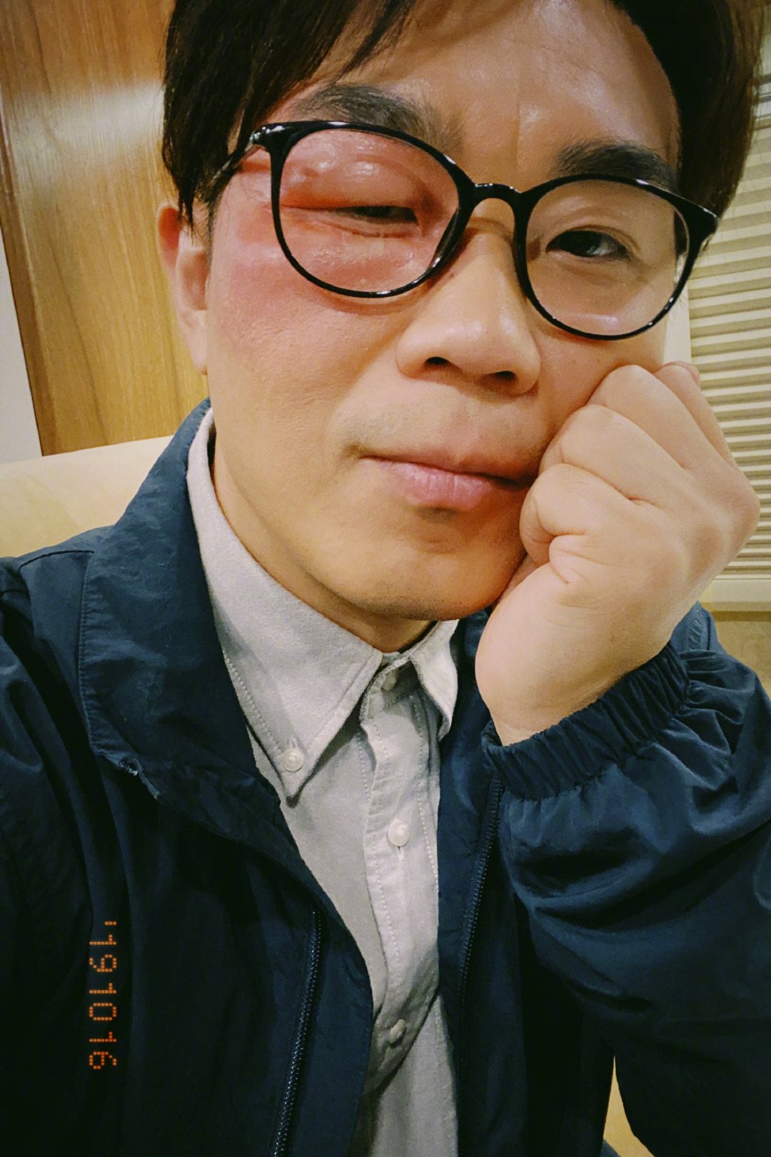 大鹏深夜晒照张脸肿的吓人 心疼之余有点想笑|受益