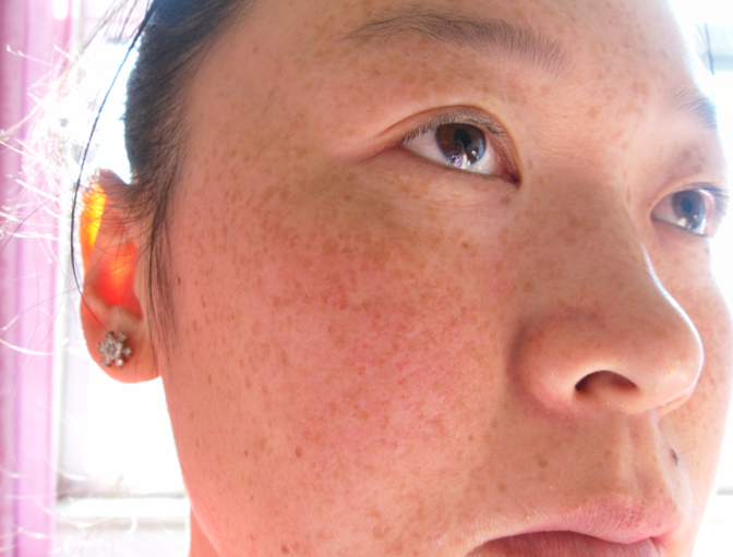 这几点了解一下|化妆品|斑点|日晒斑_新浪新闻