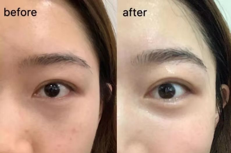 入冬后,很多人的皮肤都会干燥起皮