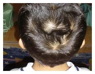 儿子头顶有两个"旋",宝妈害怕四处询问,网友调侃:太无知