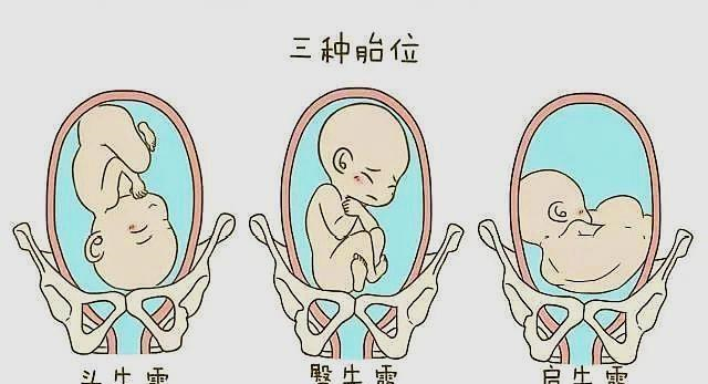 nt时宝宝在肚子里趴着怎么办呢孕3个月能看得到胎儿的性别吗