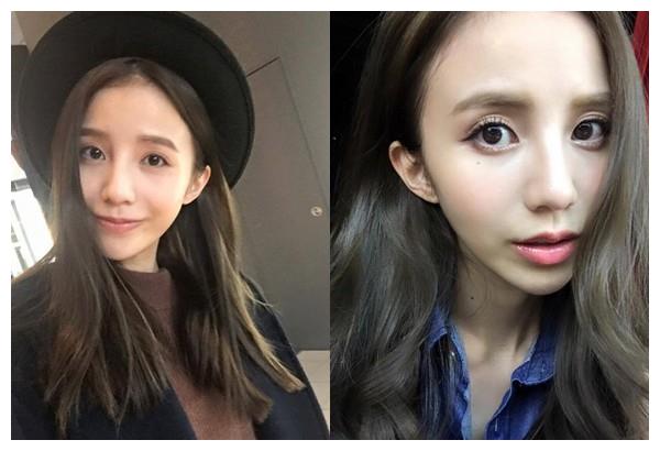 黑涩会里的牙套妹,曾经呆呆傻傻,如今箍完牙居然美得像baby