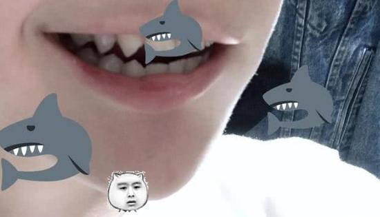 鬼鲛有鲨鱼齿,这位日本小伙也有,不过有点小可爱