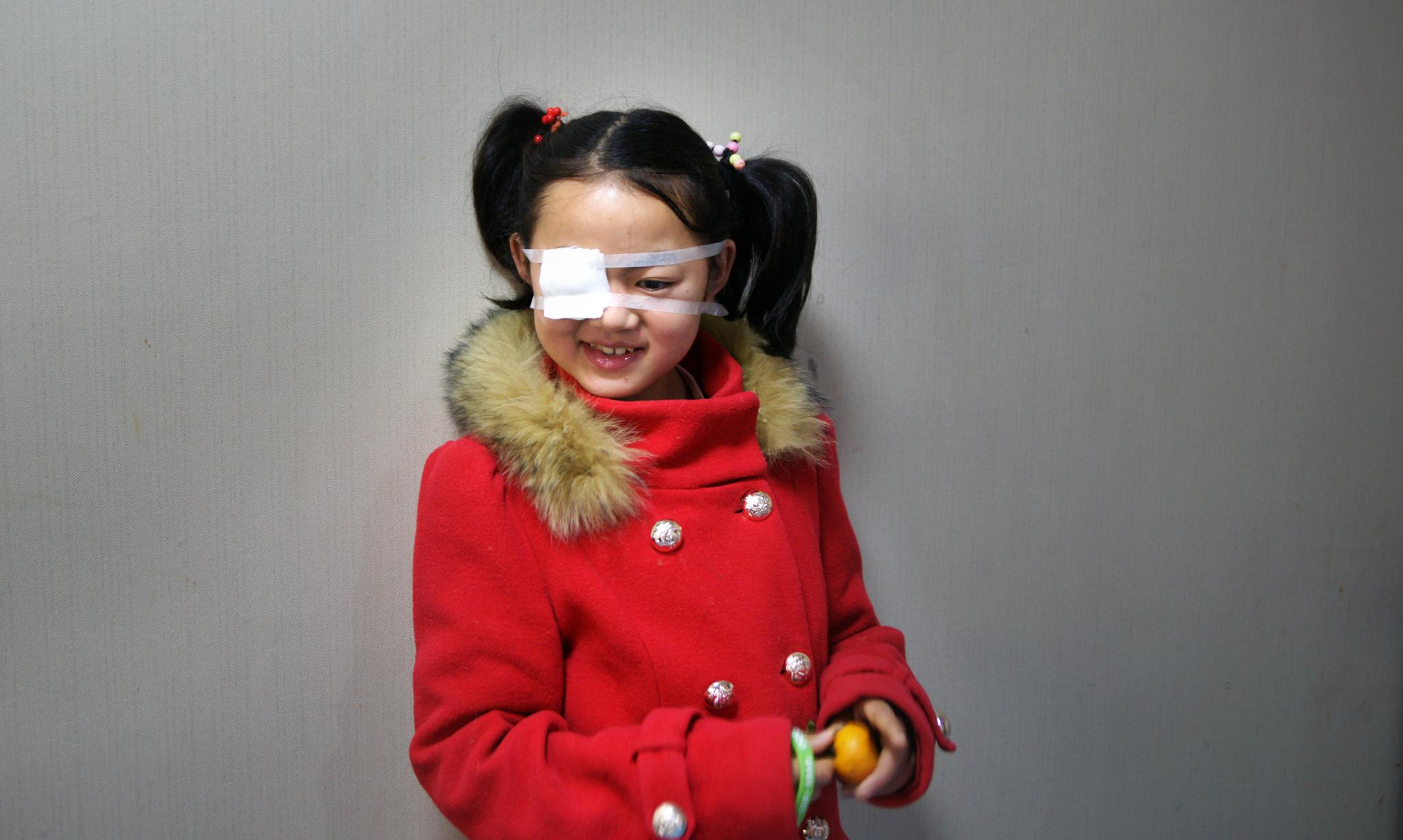 大眼睛女孩在家门口玩耍:眼球被公鸡啄爆