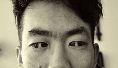 什么是双瞳孔 世界上有双瞳孔的人吗 (中国史书记载共八人)|瞳孔|史书