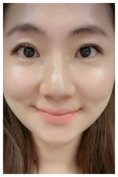 29岁拍戏被烧毁容,结婚5年后被丈夫抛弃,3年后依旧很美