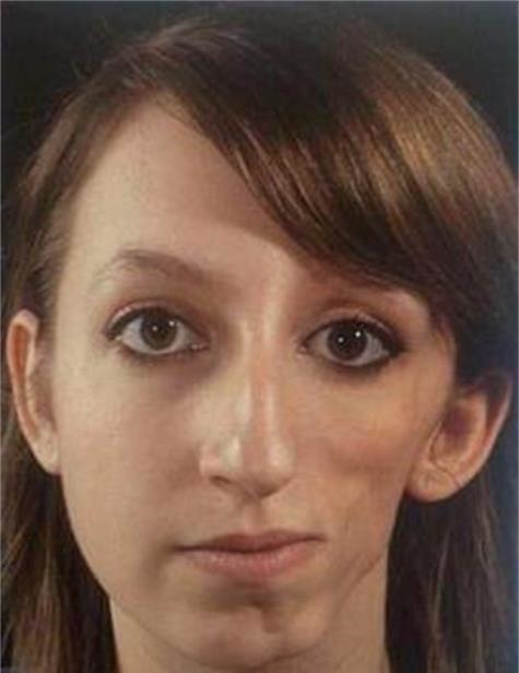 6岁女孩与朋友玩耍至脸颊"毁容",网友作为妈妈很担心孩子