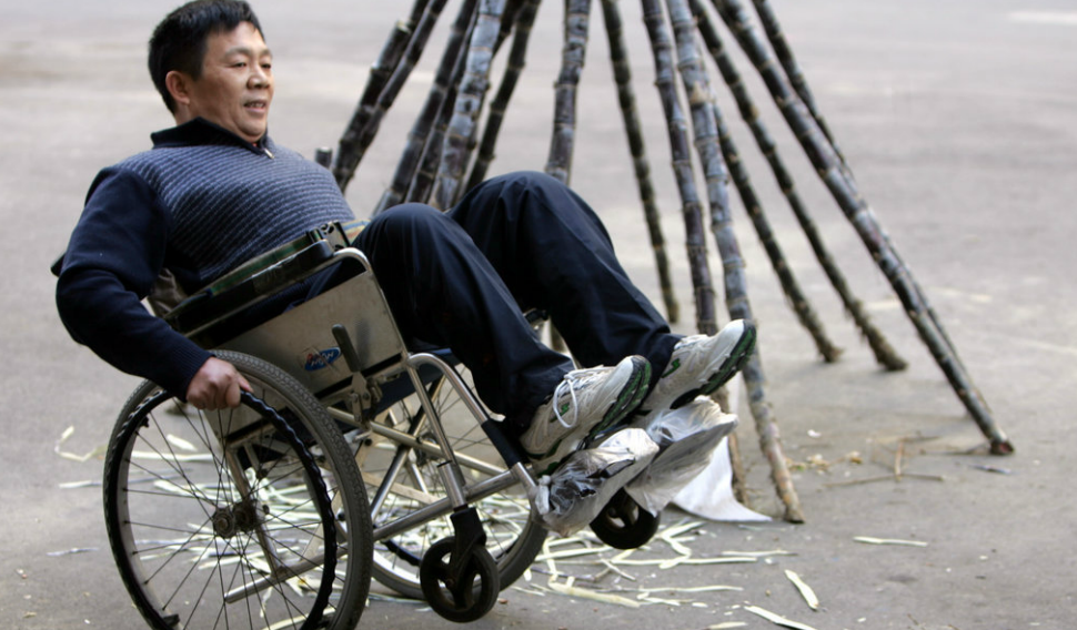 世界上截肢位最高的"半截人",只剩七十八厘米的他依然乐观生活