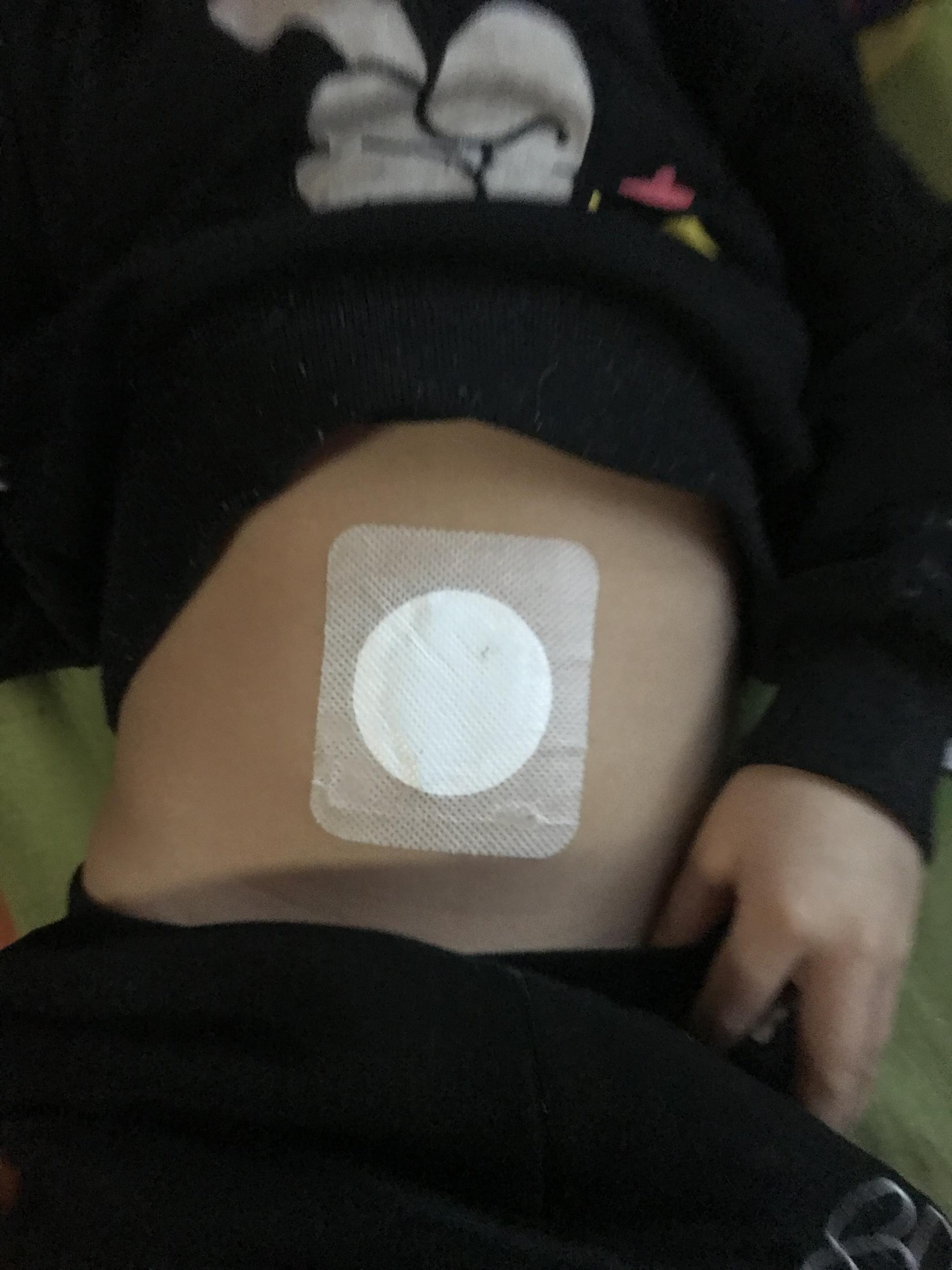 穴位给药—敷脐疗法|穴位|肚脐|小儿_新浪新闻