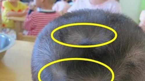 为什么有的孩子头上有“2个旋”?代表什么意思,父母要知道|宝宝|头顶|头发_新浪新闻