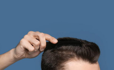 手一抓,头发就掉一大把?三个问题没注意,脱发问题缠上你