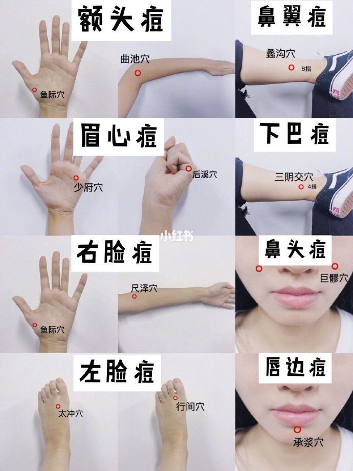 亲测有效的穴位祛痘按摩