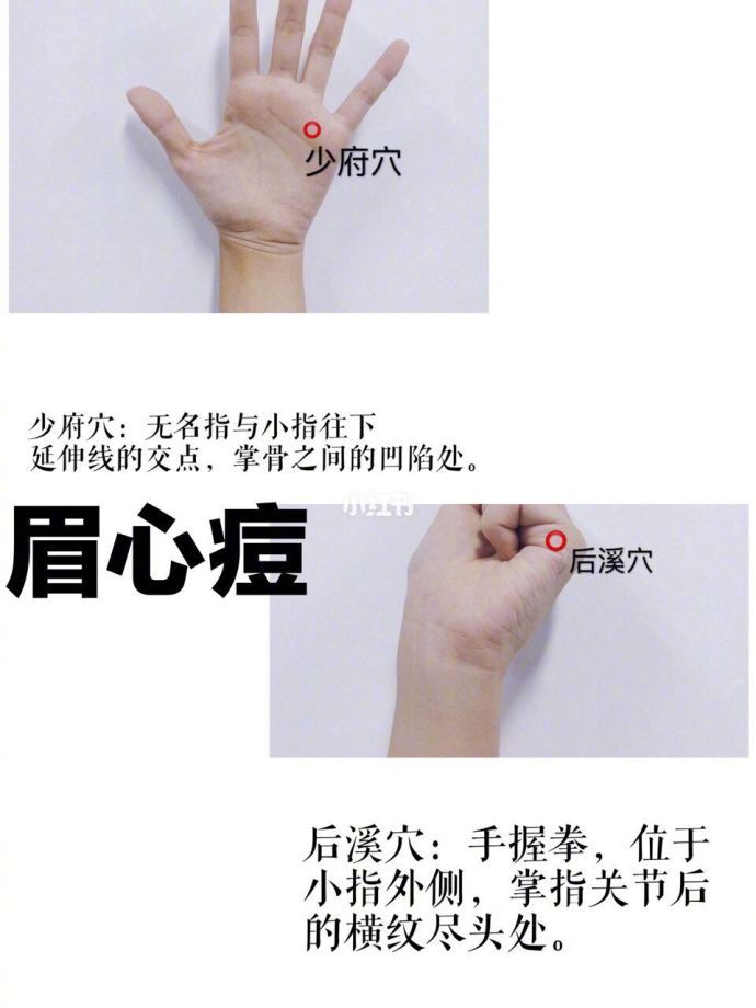 亲测有效的穴位祛痘按摩