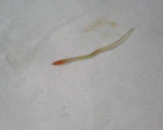 海鲜里发现一条线状"透明寄生虫",餐馆老板称其是蛏子的宝贝|蛏子