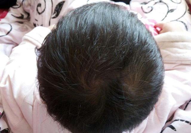 "一旋好,两旋坏,三旋脾气怪",头旋数量真的能暗示孩子性格?