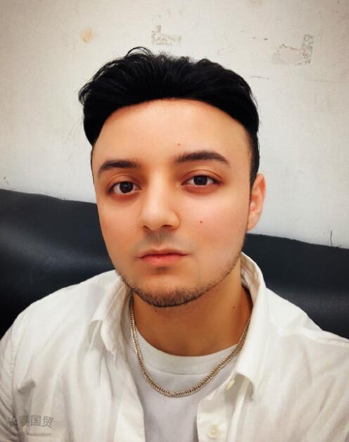 昔日童星阿尔法近照曝光戴假发现身颜值重回巅峰