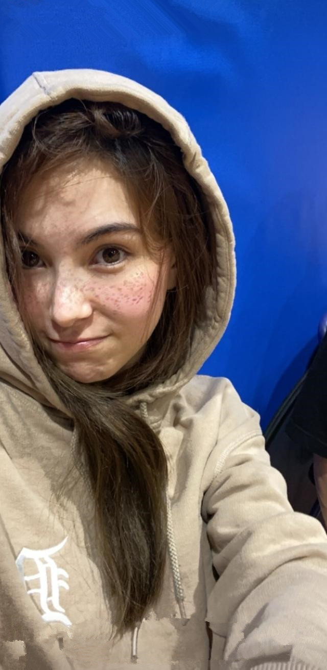 昆凌"真人"长啥样?大方展现满脸雀斑,镜头拉近被细节圈粉了!