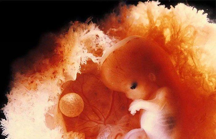 如果做了下面两件事,影响到胎囊的发育,也直接会导致后期胎儿的成长