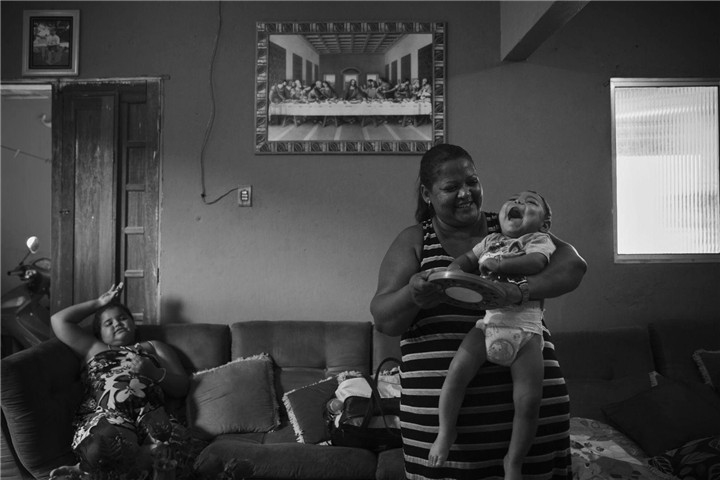 肆虐的寨卡病毒给小头症婴儿带来的伤与痛