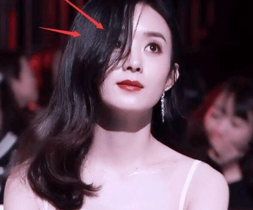 同样长麦粒肿,赵丽颖"遮伤"方式让人心疼,而戚薇却被侃作秀?
