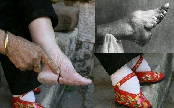 封建社会女人缠足的奇闻怪事,特别是最后一件,让人不敢相信!