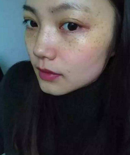 淘米水加1物,胜过"100片面膜",每天吃一点,黄褐斑乖乖走__财经头条