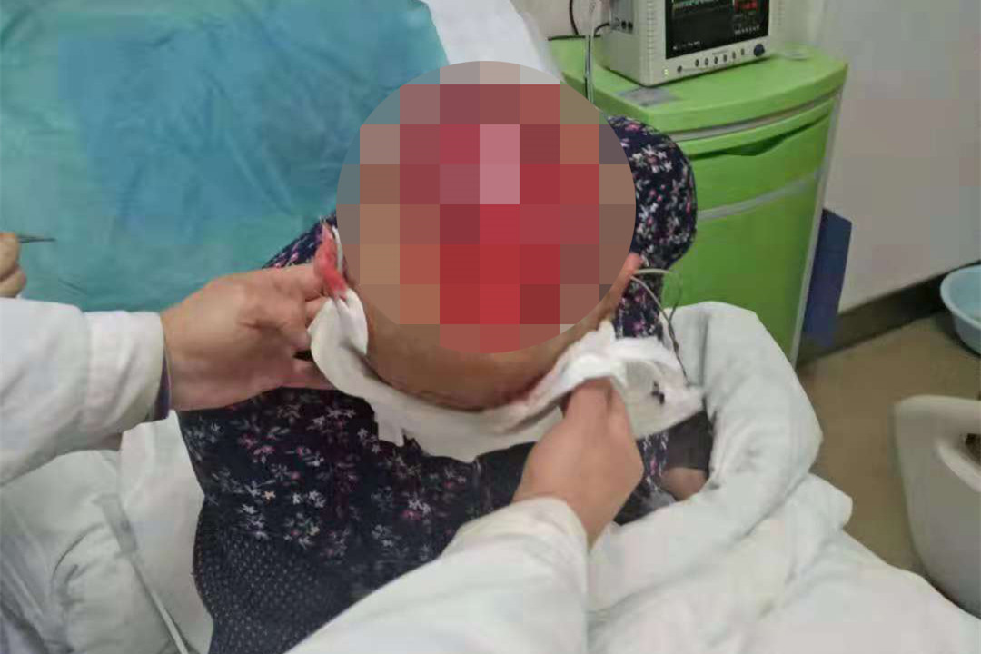 75岁老人被4条恶狗撕咬致重伤 警方:是流浪狗