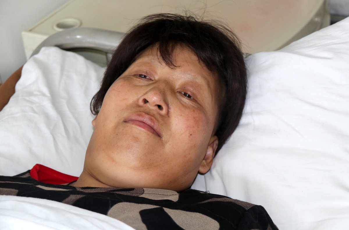 我改嫁后患癌化疗变光头天天戴假发怕儿子嫌弃常常躲着他
