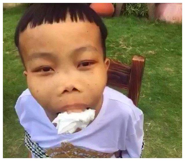 在快手上有个以丑出名的快手网红——陈山,相比大家都知道,这里不是