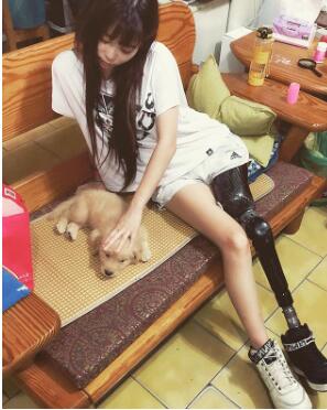 假肢|女孩|截肢_新浪新闻