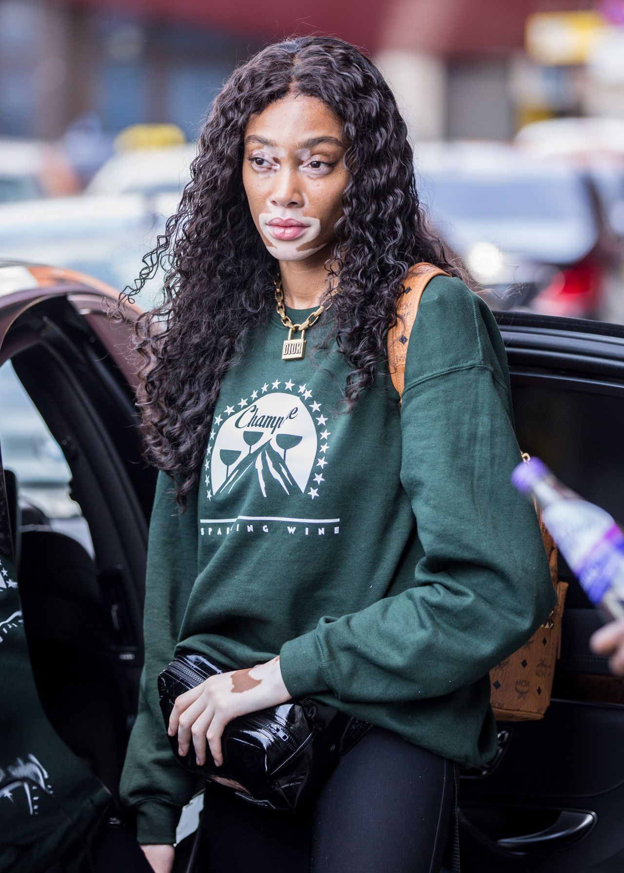 白癜风超模温妮·哈洛素颜现身机场,网友:自信的女孩最美丽!