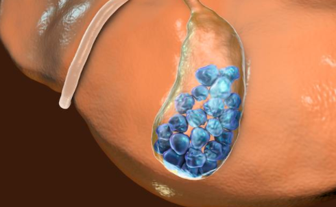 胆囊|胆汁|胆囊结石_新浪新闻