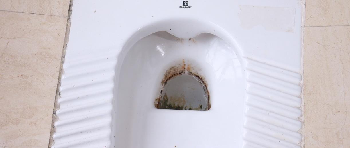 便池里全是黄斑和污垢,不用买洁厕剂,简单方法就洗得洁净如初