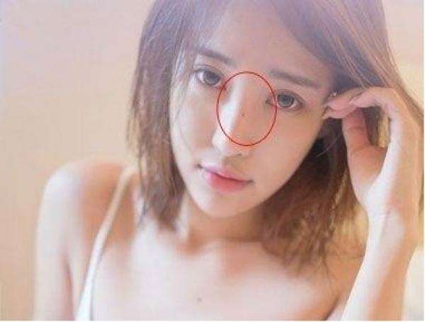 面相算命:鼻梁有痣破财千万,黑色大奔避灾挡祸