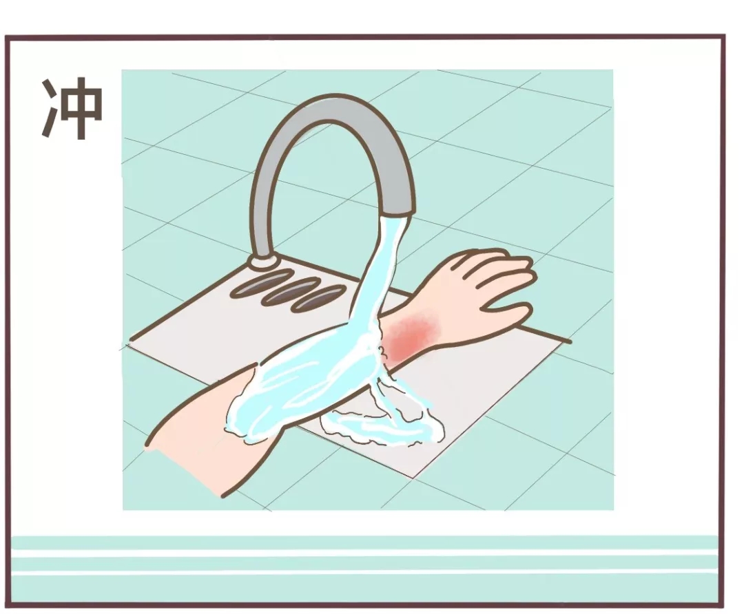 漫画丨孩子烧烫伤谨记五字诀冲脱泡盖送