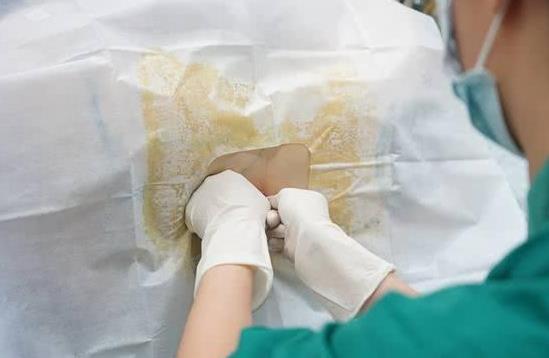 剖腹产手术前打麻醉真的会对身体有损害吗?产科大夫说了大实话