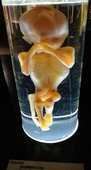 呼吸系统概观骨骼,肌肉,血管,大脑,内脏,不同的身体部位以标本的形式