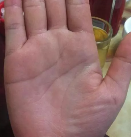 生命线尾部开叉,胃肠功能不大好,金星丘有些干扁,锻练缺乏,易疲劳,要