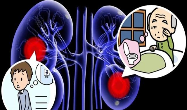夜尿增多别忽视4个建议助你有效预防夜尿症