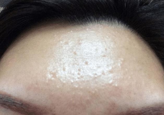 脸上出油长痘?别忽略这四个"卸妆误区"!控油清洁,减少黑头