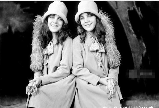 史上最有名的连体双胞胎姐妹,两人先后嫁人,结局意想不到