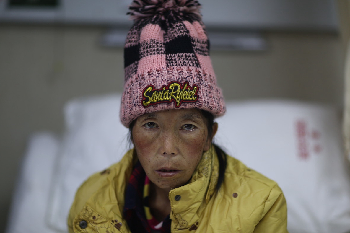 重32公斤胃癌晚期的智障女3婚怀孕家人不听医生劝告坚持保小孩