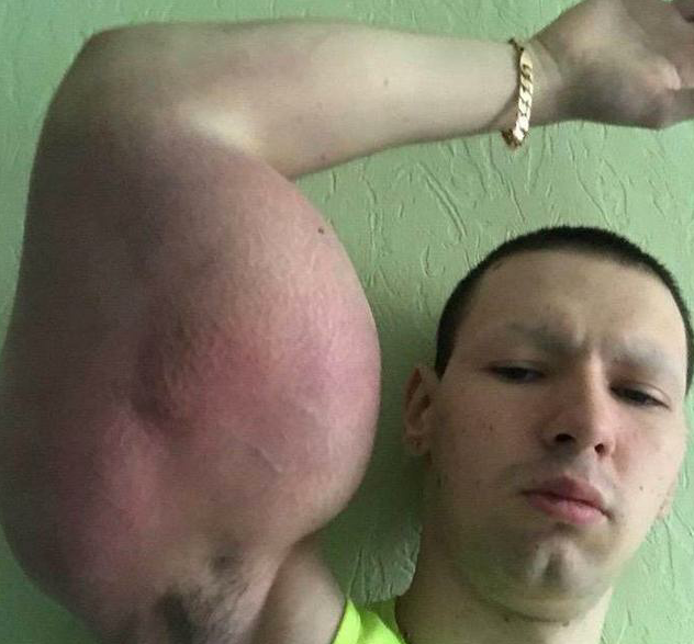 一位俄罗斯小伙,kirill tereshin就凭借着自己硕大的巨臂,走红网络.