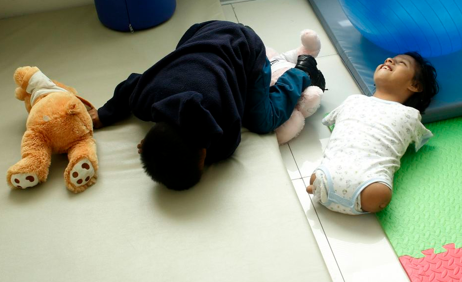 镜头下:先天性四肢切断少女的乐观人生|四肢|海豹|人生_新浪新闻